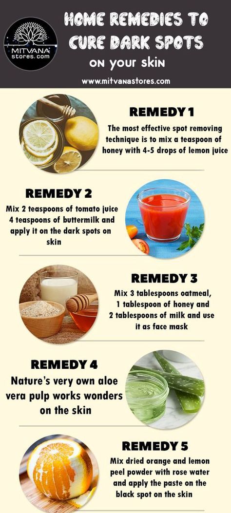 Proven Method That Will Clear the Spots on Your Face - How to Remove Dark Spots Caused by Pimples How To Remove Dark Spots On Skin, Dark Spot And Acne Scar Remover, Remedies To Remove Dark Spots On Skin, Dark Spots On Back From Acne, Skin Care For Acne And Dark Spots, Removing Acne Marks, Dark Spots On Face From Acne, Face Mask To Remove Dark Spots, How To Remove Acne Marks From Face