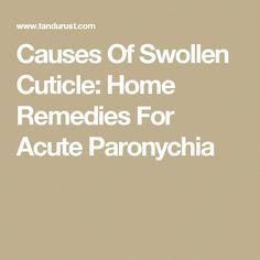 Infection of skin around the nail and cuticle is called paronychia. It is characterized by redness, swelling, warmth and pain surrounding the nail. When the cuticle is damaged bacteria enter through the damaged area causing infection. Infected Cuticle, Causes Of Fungal Infection, Remedy For Sinus Congestion, Teeth Remedies, Home Remedies For Sinus, Nail Remedies, Sinus Congestion Relief, Toenail Fungus Remedies, Nail Fungus Remedy