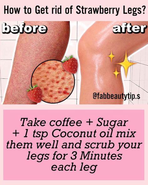 Fabbeauty Tipss on Instagram: “Follow (@fabbeautytip.s ) For Daily Powerful Posts💯 👇 TURN ON POST NOTIFICATIONS🔔 👇 ⏭️ @fabbeautytip.s ⏮️ ⏭️ @fabbeautytip.s ⏮️ ⏭️…” How To Get Rid Of Strawberry Legs Fast Naturally, Rid Of Strawberry Legs Beauty Tips, Strawberry Legs, How To Tan, Overnight Beauty, Home Health Remedies, Natural Skin Care Routine, Perfect Skin Care Routine, Healthy Skin Tips