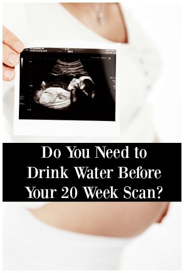 Do You Need to Drink Water Before Your 20 Week Scan? 20 Week Ultrasound, Second Trimester Workouts, 20 Week Scan, Second Trimester, Trimesters Of Pregnancy, First Trimester, Ultrasound, Do You Need, Drinking Water