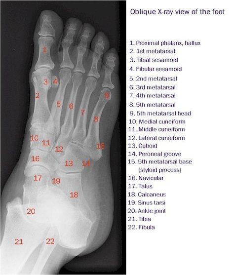 Radiography Student, Radiology Schools, Medical Radiography, Radiologic Technology, Medical Assistant Student, Radiology Student, Radiology Technician, Radiology Imaging, Physical Therapy Assistant