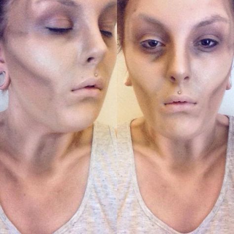 EMACIATION RESEARCH Hollow Face Makeup, Zombie Makeup Realistic, Dead Body Makeup, Cool Zombie Makeup, Zombie Sfx Makeup Gore, Emaciated Look, Sfx Makeup Wounds, Dead Person Makeup, Gory Sfx Makeup