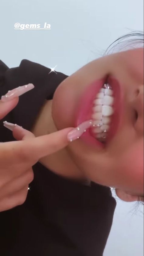 Diamond Teeth Aesthetic, Kylie Jenner Teeth, Tooth Gem Placement, Teeth Aesthetic, Gem Makeup, Pretty Teeth, Dental Jewelry, Grillz Teeth, Lips Nails