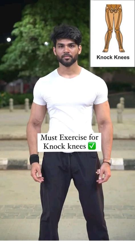 top 5 exersize knock kness. in 2022 | Workout videos, Shoulder workout, Gymnastics workout Knees Exercises, Knock Knees Exercises, Knock Knees, Bodybuilding Workouts Routines, Workout Routine For Men, Workout Training Programs, Leg And Glute Workout, Abs And Cardio Workout, Knee Exercises