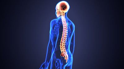 What's going on in the Fibromyalgia Brain and Nervous System? Straight Spine, Brain And Nervous System, Chronic Pain Relief, Family Chiropractic, The Mechanisms, Brain Scan, Good Shoes, Spine Health, Muscle Strain