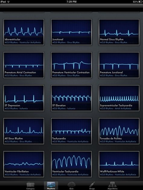 ACLS Rhythms Cheat Sheet | Welcome, Guest | Login | Register | Forgot Password |: Ekg Interpretation, Nursing Information, Nursing Cheat, Cardiac Nursing, Nursing School Survival, Critical Care Nursing, Nurse Rock, Nursing School Studying, Nursing School Tips