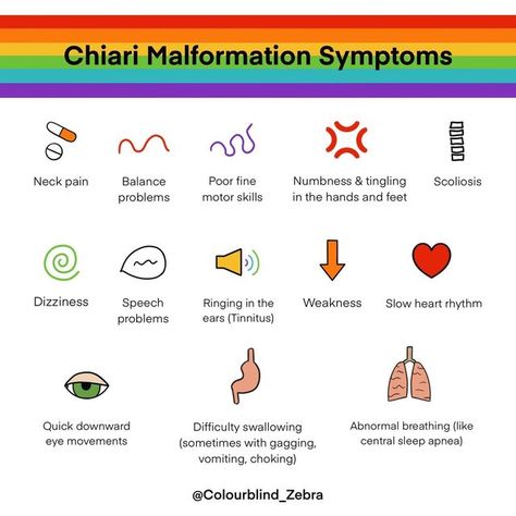 Chiari Malformation Quotes, Chiari Malformation Type 1, Chiari Malformation Surgery, Chiari Malformation Awareness, Medical Things, Forward Head Posture Exercises, Medical Diagnosis, Neck And Shoulder Muscles, Chiari Malformation