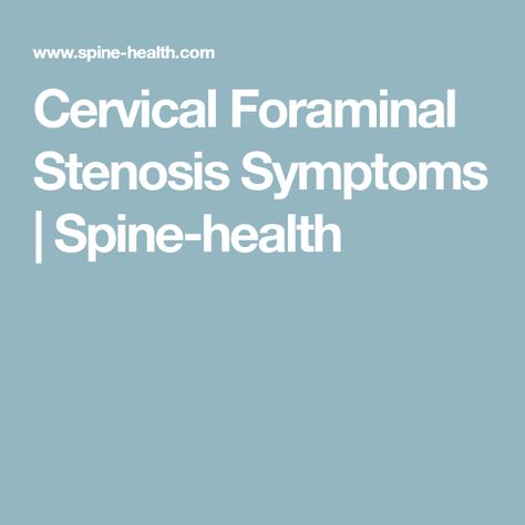 Cervical Foraminal Stenosis Symptoms | Spine-health Foraminal Stenosis, Spinal Degeneration, Cervical Disc, Neck Ache, Cervical Spondylosis, Spinal Nerve, Spine Health, Cervical Spine, Stiff Neck