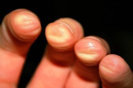 Sore Guitar Fingers? Check this out for tips on getting rid of the finger soreness from playing guitar. Beginner Guitar Lessons, Bass Guitars For Sale, Guitar Fingers, Beginner Guitar, Bass Guitar Lessons, Learn Violin, Violin Lessons, Guitar Practice, Learn To Play Guitar