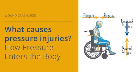 What causes pressure injuries? How Pressure Enters the Body Pressure Canning, Wound Care, Occupational Therapist, Long Term Care, Hot Topics, Skin Health, The Body, Sense, Healing