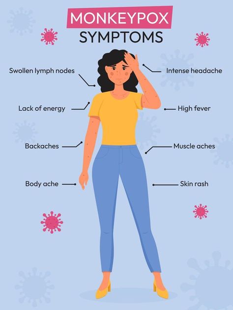 Monkeypox outbreak. Monkeypox virus symptoms infographic. Flat vector illustration for informing people about an infectious disease. Virus Symptoms, Infectious Diseases, High Fever, Flat Vector Illustration, Lack Of Energy, Lymph Nodes, Body Ache, Muscle Aches, Yay Images