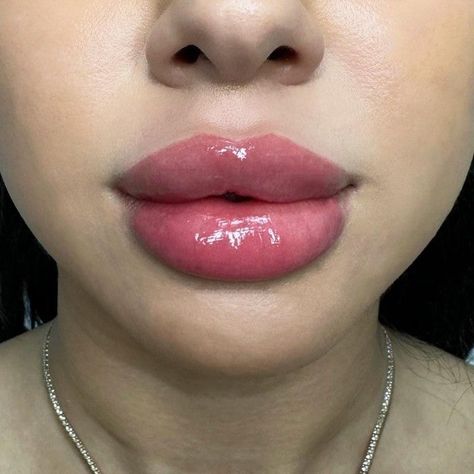 Big Lip Filler, Big Lips Aesthetic, Desired Lips, Lip Filler Inspiration, 1ml Lip Filler, Big Lips Natural, Fairy Eyes, Lips Inspiration, Botox Lips