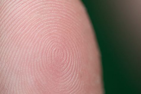 Genetics experts used to think that the same mechanisms behind skin development helped shape fingerprint patterns. A new study tests that. Deposit PhotosThe whorls, arches, and loops on your fingertips can say a lot about your early development. The post The genes behind your fingerprints just got weirder appeared first on Popular Science. Edwards Syndrome, Chromosomal Disorders, Types Of Fingerprints, Third Month Of Pregnancy, Dubai Video, Satisfying Pictures, Genetic Disorders, Popular Science, Study Test