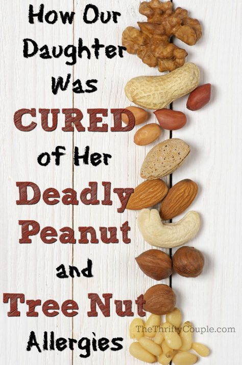 are seeds tree nuts - Google Search Allergy Remedies For Kids, Tree Nut Allergy, Nut Allergy, Food Allergies Awareness, Herbal Therapy, Egg Allergy, Kids Allergies, Allergy Awareness, Healthy Nuts