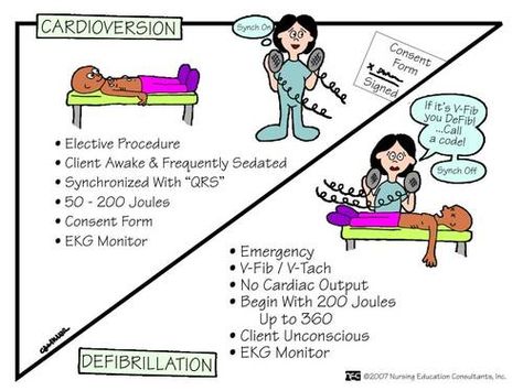 Cardioversion vs. Defirbillation.  Cardioversion is an elective procedure, requiring a signed consent.  Defibrillation is an emergency intervention! V-fib = D-fib!! Nursing 101, Nursing Information, Nursing Assessment, Nursing Mnemonics, Surgical Nursing, Medical Surgical Nursing, Cardiac Nursing, Nursing School Survival, Critical Care Nursing