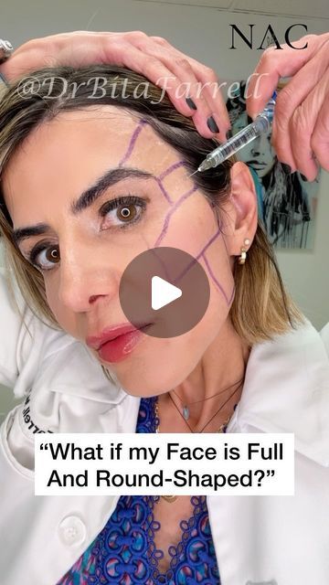 Dr. Bita Zadeh Farrell on Instagram: "All face shapes are beautiful.  Period!  As the face matures and ages, there can be volume loss in the lateral part of the face - in the temple, pre-auricular (in front of ear), and jawline.  This can create a central or mid face heaviness.   Oval or heart shaped faces are longer than they are wide, with the cheekbones being the widest part of the face; which gives for a more contoured appearance.  Adding dermal fillers and/or Biostimulators to the lateral part of the face can help balance and add definition to a rounded or mid-heavy face.   #facialbalancing #facialharmonization #faceshape #drbitafarrell #naturalaestheticscenter" Cheek Fillers Round Face, Face Balancing Fillers, Heart Shaped Faces, Botox Filler, Face Fillers, All Face Shapes, Botox Fillers, Heart Face, Heart Face Shape