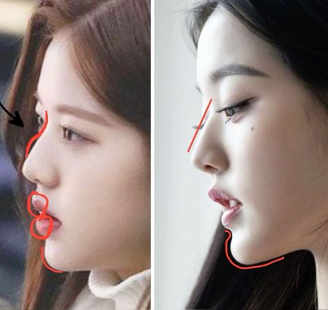 Button Nose Surgery, Wonyoung Nose, Kpop Plastic Surgery, Jaw Reduction Surgery, Surgery Nose, Face Plastic Surgery, Nose Surgery Rhinoplasty, Really Bad Tattoos, Plastic Surgery Fail