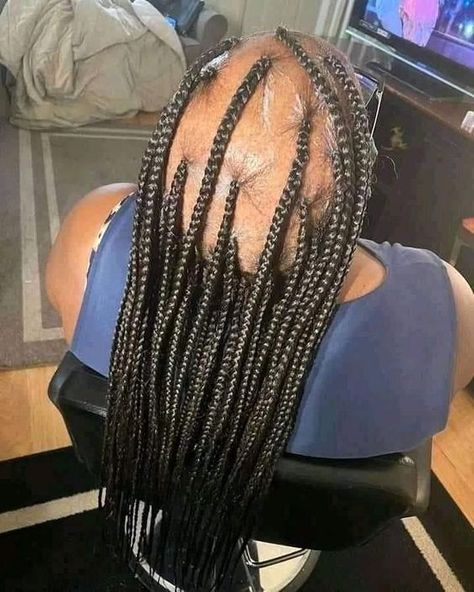 Black Hair Quick Weave, Ugly Hair, Cute Box Braids, Braids For Boys, 50s Women, Cute Box Braids Hairstyles, Girls Braids, Funny Picture, Short Black Hairstyles