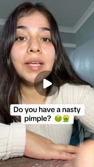 Dalila Gomez on Instagram: "Do you have a nasty pimple? #pimples #pimpleremover" How To Make Pimple Patches At Home, How To Cover Up Pimples, Diy Pimple Patch, How To Get Rid Of Pimples Overnight, Pimple Remedies Overnight, Cover Up Pimples, Neck Pimples, Cystic Acne On Chin, Peroxide For Acne