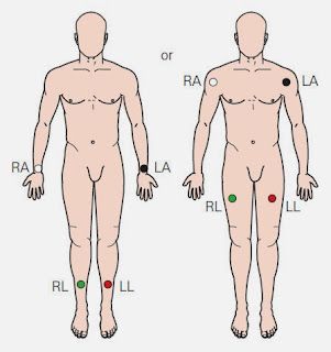 12 Lead Ekg Placement, Ekg Placement, Lead Placement, Cardiac Cycle, Ecg Interpretation, P Wave, Electric Field, Male Torso, 100 Years Ago