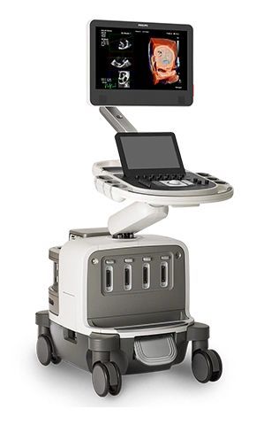 Cardiovascular ultrasound requires quicker screen revives than some other application as the need might arise to be precisely estimated and envisioned. Post test picture and video cut handling are significantly more typical in heart ultrasound machines than in frameworks streamlined for different applications. Heart Ultrasound, Cardiac Ultrasound, 4d Ultrasound, Ultrasound Machine, Service Excellence, Magnetic Resonance Imaging, Magnetic Resonance, Medical Imaging, Radio Wave