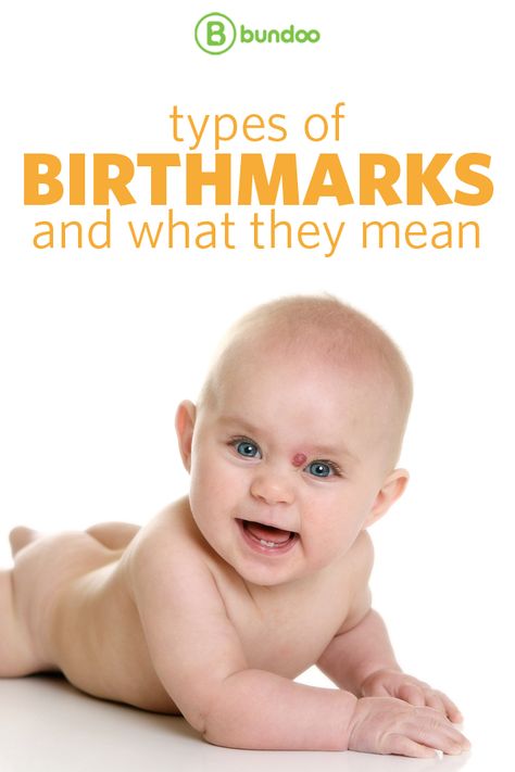 There are many names for birthmarks, but what do they all mean for your child? Hispanic Names, Bohemian Baby Names, Hispanic Baby Names, Bible Baby Names, Disney Baby Names, Hispanic Babies, Old Fashioned Baby Names, Country Baby Names, Hipster Baby Names