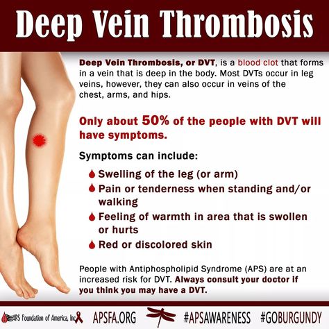 Awareness Month - Day 26: Deep Vein #Thrombosis or #DVT. How many people have suffered from a DVT? Did you have one prior to or after your #APS diagnosis?? It's important to know the signs and symptoms of a DVT because it is one of the clinical features of APS (#Antiphospholipid Syndrome). Don't forget the hashtags #AntiphospholipidSyndrome #APSAwareness #GoBurgundy #APSMatters when sharing. Dvt Symptoms, Pitting Edema, Hospital Medicine, Nurse Study, Leg Veins, Vein Thrombosis, Low Estrogen Symptoms, Nurse Study Notes, Too Much Estrogen