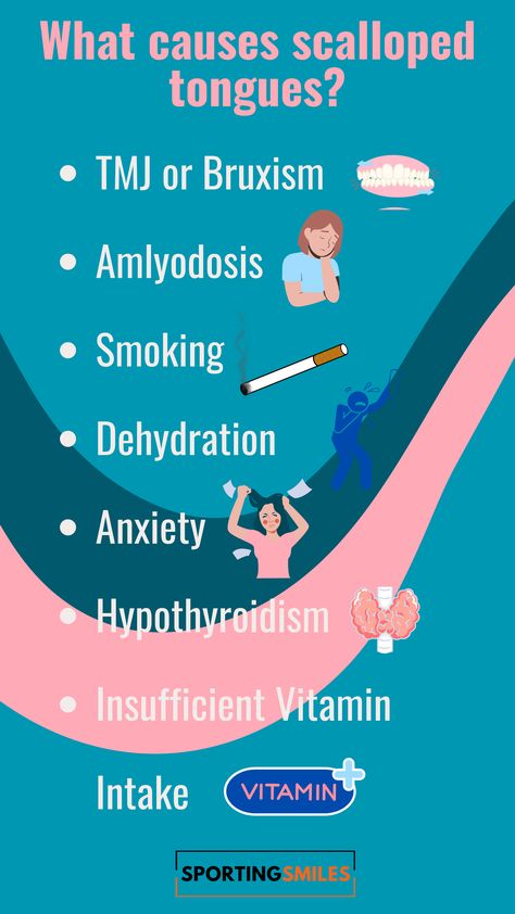 Have you noticed your tongue has shown a wavy shape recently? If so this could mean you have a scalloped tongue, scalloped tongues aren’t a permanent shape but they could mean poor oral health or other medical issues. Scalloped Tongue, Jaw Clenching, Swollen Tongue, Teeth Grinding, Grinding Teeth, Body Ache, Medical Conditions, Oral Health, Medical