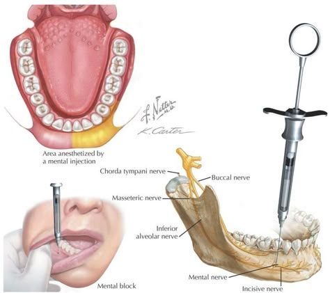 Cranial Nerves Anatomy, Nerves Anatomy, Anatomy Dental, Trigeminal Nerve, Dental Hygienist School, Local Anesthesia, Dental Assistant Study, Dental Hygiene Student, Female Dentist