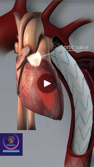 193K views · 3.3K reactions | Aortic Valve - 3D animation #heartvalve #medical #animation #foryou #fpyシ | Medical Animation Media | Medical Animation Media · Original audio Jugular Venous Pressure, Medical Animation, Heart Valves, 5th Grade Science, Video Animation, 5th Grade, 3d Animation, Medical, Science