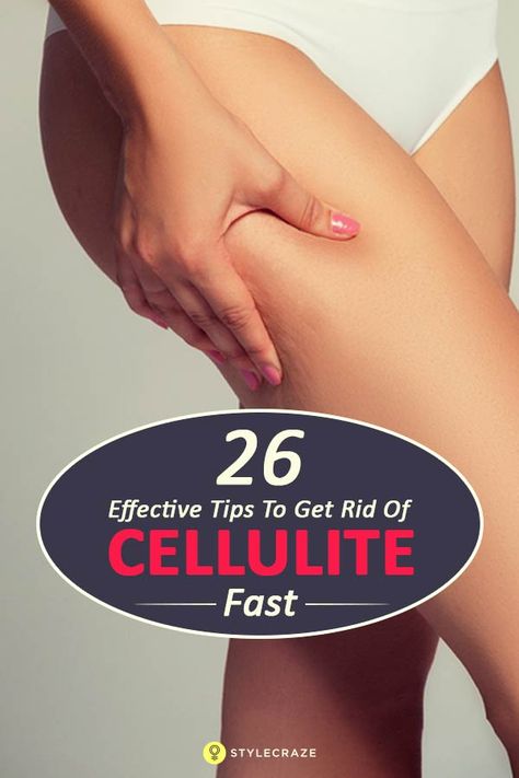 24 Best Ways To Get Rid Of Cellulite Fast Health Tricks, Highlight Colors, Exercise Workouts, Acne Mask, Squat Challenge, Postpartum Body, Fat Removal, Do Exercise, Workout Ideas