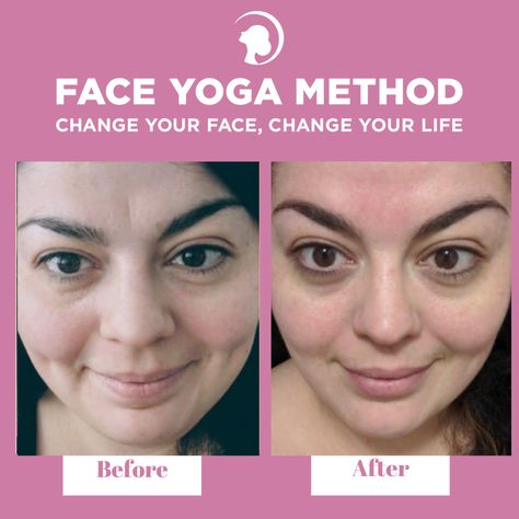 🔥 #TRANSFORMATIONTUESDAY   Julia was shy about sharing her transformation but she wanted to encourage anyone who needed a boost! 👏   Give Face Yoga a try and transform your face!   #faceyogamethod #wrinkles Aging Healthy, Face Gym, Facial Exercise, Face Yoga Method, Pilates Stretches, Face Tone, Face Yoga Exercises, Reverse Aging, Under Eye Wrinkles