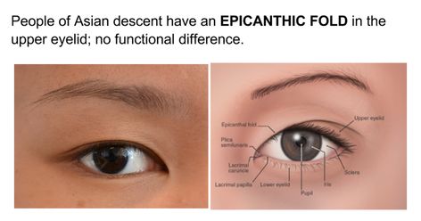 Epicanthic Fold Eye, Epithantic Folds Eyes, Triple Eyelid, Monolid Vs Hooded Eyes, Eyelid Surgeries, Epicanthic Fold, Lasik Eye Surgery Tips, Body References, Cranial Nerves