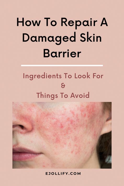 How To Fix Damaged Skin Barrier, How To Know If Your Skin Barrier Is Damaged, Skin Repair Remedies, Compromised Skin Barrier, How To Fix Skin Barrier, How To Heal Skin Barrier, Moisture Barrier Skin Care, How To Restore Skin Barrier, Heal Skin Barrier