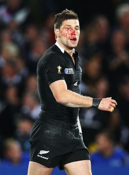 . Covered In Blood Reference, Rugby Injuries, Rugby Motivation, All Black Rugby, Rugby Images, Rugby Workout, Nz All Blacks, Rugby Tackle, Rugby Boys