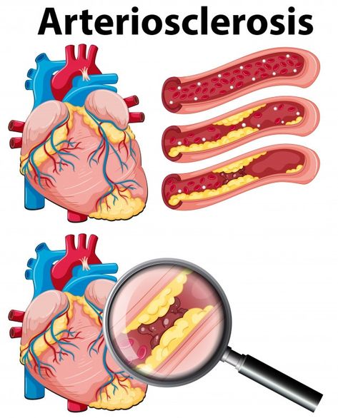 Aloe Vera Gel Drink, Sistem Saraf, The Human Heart, Medical Photos, Nursing School Notes, Medical School Essentials, Educational Infographic, Body Therapy, Coronary Arteries