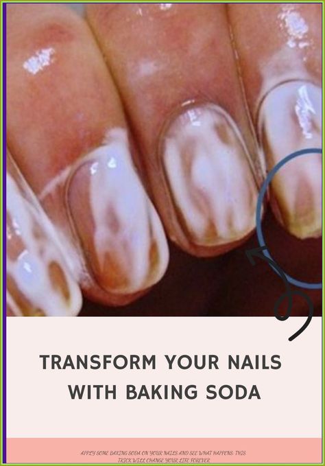 Unleash a stunning transformation in your nails through the power of baking soda Soda Nails, Baking Soda Nails, Diy Natural Detergent, Fruit Recipes Healthy, Nutrition Drinks & Shakes, Healthy Book, Healthy Lifestyle Quotes, February Nails, Bicarbonate Of Soda