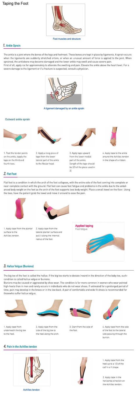 Ankle Exercises, K Tape, Manual Therapy, Kinesio Tape, Kt Tape, Kinesio Taping, Barefoot Running, Ankle Pain, Kinesiology Taping