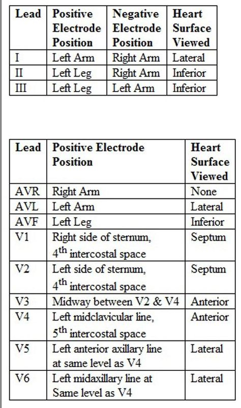 12 Lead Ekg Placement, Ekg Placement, Ecg Placement, Lead Placement, Ekg Technician, Emt Study, Cardiology Nursing, Ekg Interpretation, Medical Assistant Student