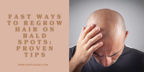 Before and after images of hair regrowth on bald spots, showcasing effective methods and treatments Bald Spot, Boost Hair Growth, Regrow Hair, Lifestyle Changes, Hair Growth, Natural Remedies, Confidence, Lifestyle, Hair