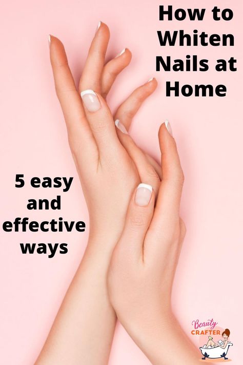 How To Whiten Nails, Make Nails White, Stained Nails, Denture Cleaner, Nail Discoloration, Nail Whitening, Yellow Nails Design, Nail Soak, Tongue Health