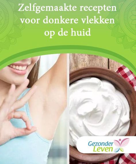 Zelfgemaakte recepten voor donkere vlekken op de huid Overmatige blootstelling aan de zon, het gebruik van deodorants of bepaalde producten, dit zijn enkele van de oorzaken van donkere vlekken op de huid. Deodorant, Van, Hair, Beauty