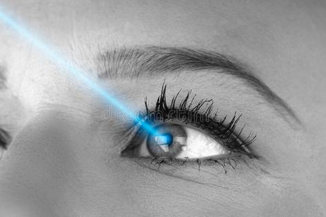 Laser Vision Correction, Laser Vision, Blurred Vision, Lasik Surgery, Vision Loss, Eyes Problems, Medical College, Medical Science, Dry Eyes