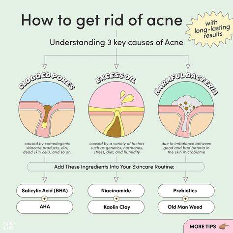 Get the lowdown on ditching acne 👀 Acne Location Meaning, Neck Acne Causes, Acne Map, Neck Acne, Chin Acne, Travel Skincare, Acne Gel, Miss Girl, Natural Face Skin Care