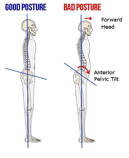 Posture Muscles, Stretches For Neck, Quad Strengthening, Flat Feet Exercises, Weak Glutes, Hip Flexor Pain, Back Spasm, Psoas Release, Posture Fix