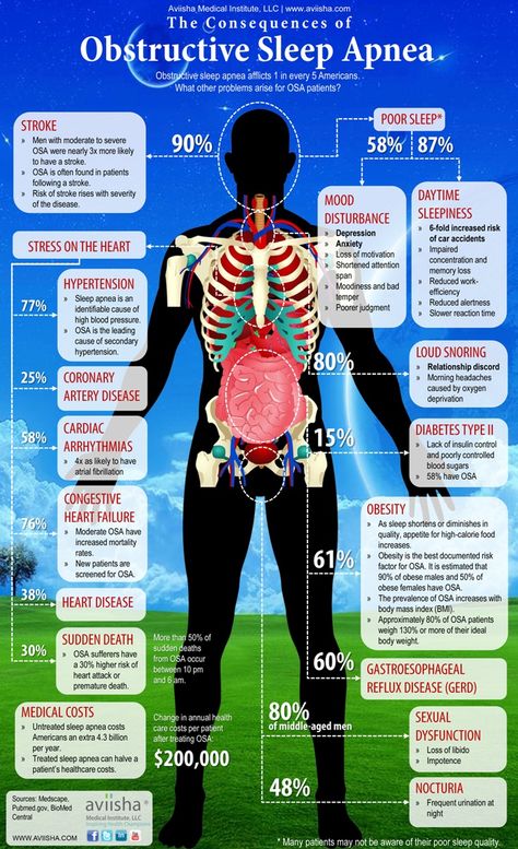 Sleep Apnea Loss Of Motivation, Insomnia Causes, Snoring Remedies, Respiratory Therapy, Ways To Sleep, Sleep Health, Loose Skin, How To Get Sleep, The Human Body