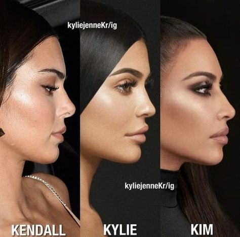 #plasticsurgery #plasticsurgerygonewrong #beforeafter #celebritiesbeforeafter #hollywoodstars #bignosesurgery #surgery #facesurgery #vlinesurgery #koreanplasticsurgery #kpopplasticsurgery #nosejob #jawreductionsurgery #eyesurgery #cheekfillers #rhinoplasty #facelift Kylie Jenner Nose Job, Kylie Jenner Profile, Kylie Jenner Nose, Kylie And Kim, Kpop Plastic Surgery, Jaw Reduction Surgery, Rhinoplasty Nose Jobs, Face Surgery, Plastic Surgery Gone Wrong