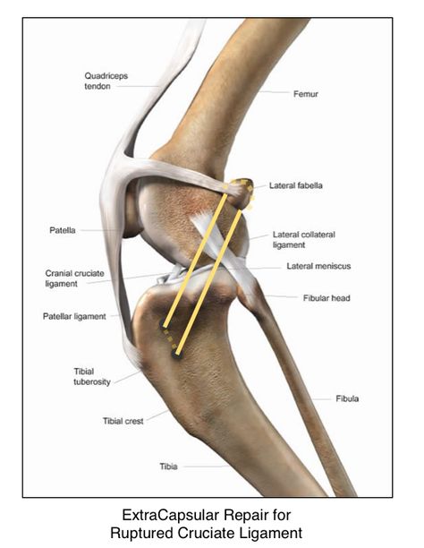 Knee Injuries: The Ruptured Anterior Cruciate Ligament (ACL) in Dogs — VAH Veterinarians Medicine, Dog Cpr, Vet Science, Common Knee Injuries, Human Knee, Vet Notes, Knee Ligaments, Human Digestive System, Anterior Cruciate Ligament