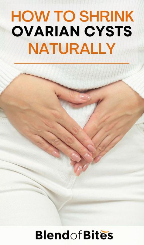 Cystic Ovaries, Fallopian Tubes, Natural Health Remedies, Natural Treatments, Best Diets, Health Remedies, Natural Remedies, Healing, Health