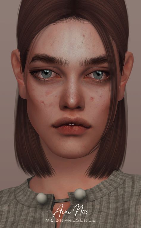 Ts4mm Skin, Sims 4 Cc Skin Imperfections, Sims 4 Skin Details Acne, Pimples Sims 4 Cc, Sims 4 Cc Skin Acne, Sims 4 Cc Pimple Patches, Sims 4 Cc Acne Patreon, Sims 4 Pimples Cc, Acne Cc Sims 4